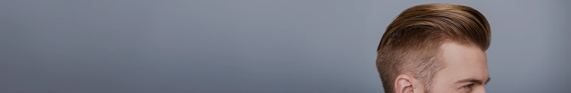 Intensiv schuppendes Haar